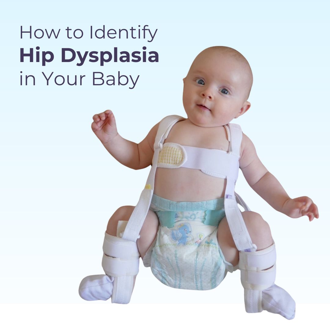 Hip Dysplasia in Babies