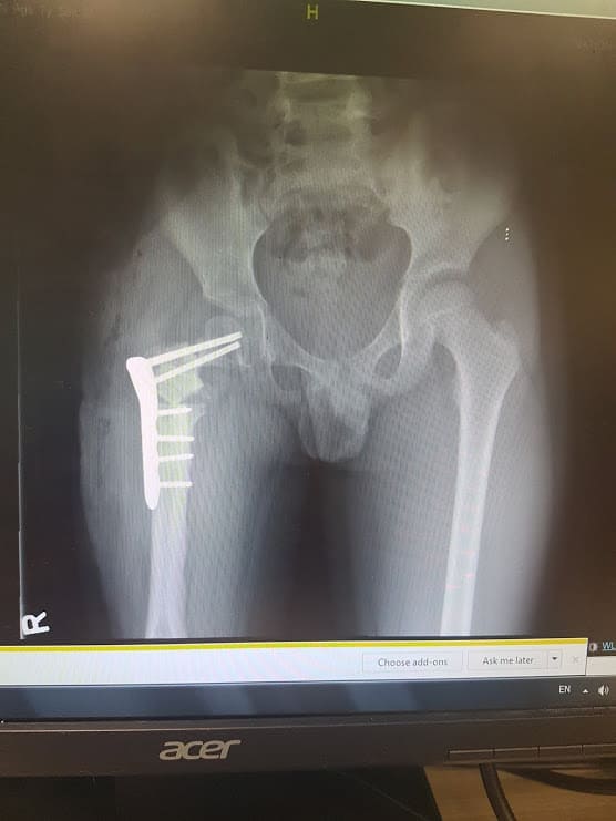 Loading Image